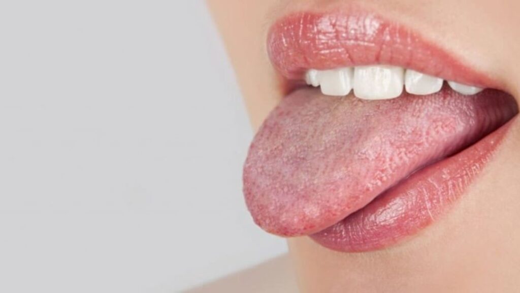 How To Cure Mouth Ulcers Fast Naturally: Nature's Fast Track To Relief